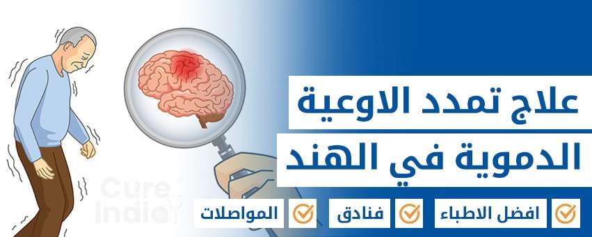 علاج تمدد الأوعية الدموية في الدماغ